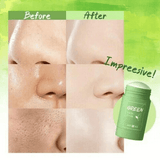 Green Tea Face Mask Stick – Acne Control, Blackhead Cleanser & Skin Brightening